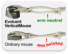 An Evoluent product. The VMOUS4RS is a SMALL RIGHT HANDED Evoluent VerticalMouse. Patented design that supports your hand in a relaxed handshake position- and eliminates the arm twisting required by ordinary mice. The 4 is the latest evolution of this awa thumbnail